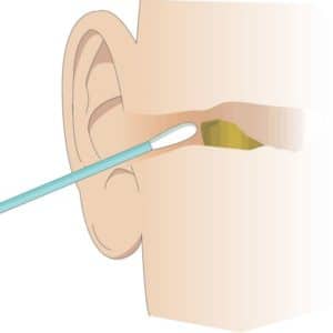 remove your own ear wax
