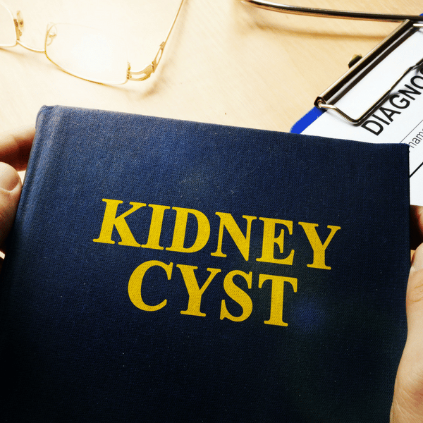 kidney cyst causes